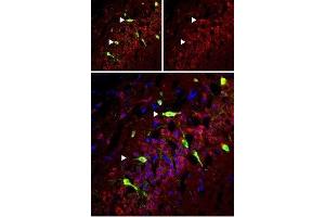 Expression of mGluR5 in rat hippocampus - Immunohistochemical staining of perfusion-fixed frozen rat hippocampus sections using Anti-mGluR5 (extracellular) Antibody (ABIN7043250, ABIN7044332 and ABIN7044333), (1:50).