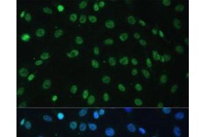 Immunofluorescence analysis of C6 cells using HNRNPD Polyclonal Antibody at dilution of 1:100.
