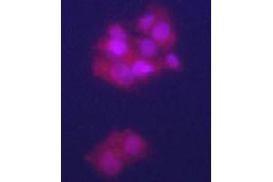 Immunofluorecence staining of GPC3 polyclonal antibody  on HepG2 cells . (Glypican 3 anticorps  (N-Term))