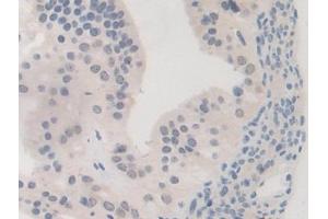 Detection of BRD8 in Mouse Oviduct Tissue using Polyclonal Antibody to Bromodomain Containing Protein 8 (BRD8)