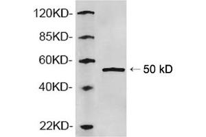 Western blot analysis of recombinant human AP2M1 protein using 1 µg/mL Rabbit Anti-AP2M1 Polyclonal Antibody (ABIN398781) The signal was developed with IRDyeTM 800 Conjugated Goat Anti-Rabbit IgG.
