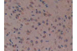 DAB staining on IHC-P; Samples: Mouse Brain Tissue (Complement Factor H anticorps  (AA 915-1156))