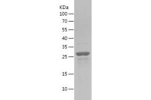 Western Blotting (WB) image for Axin 1 (AXIN1) (AA 540-768) protein (His tag) (ABIN7121954)