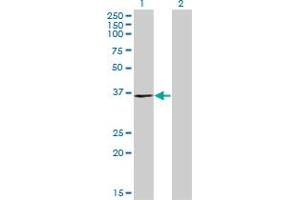 Western Blot analysis of C20orf77 expression in transfected 293T cell line by C20orf77 monoclonal antibody (M04), clone 4D6. (RPRD1B anticorps  (AA 1-326))