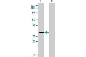 Western Blot analysis of FCER1A expression in transfected 293T cell line by FCER1A monoclonal antibody (M01), clone 2C12-3B6. (Fc epsilon RI/FCER1A anticorps  (AA 1-257))
