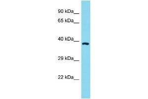 Host: Rabbit Target Name: OR11A1 Sample Type: HT1080 Whole Cell Lysate lysates Antibody Dilution: 1. (OR11A1 anticorps  (C-Term))