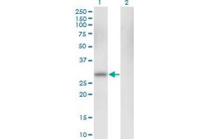 Western Blot analysis of CA1 expression in transfected 293T cell line by CA1 monoclonal antibody (M05), clone M1.