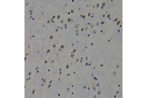 Immunohistochemistry of paraffin-embedded mouse brain using DNMT3B antibody at dilution of 1:200 (400x lens). (DNMT3B anticorps)
