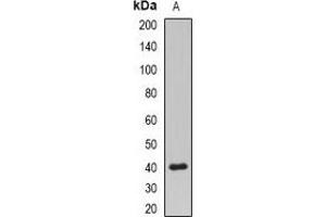 Western blot analysis of PPP2R4 expression in MCF7 (A) whole cell lysates.