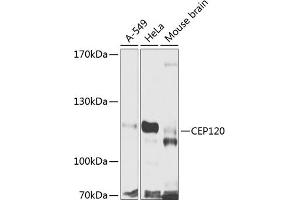 Western blot analysis of extracts of various cell lines, using CEP120 antibody (ABIN6133305, ABIN6138415, ABIN6138416 and ABIN6224025) at 1:1000 dilution. (CEP120 anticorps  (AA 1-270))