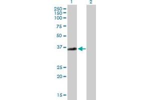Western Blot analysis of ANXA3 expression in transfected 293T cell line by ANXA3 MaxPab polyclonal antibody. (Annexin A3 anticorps  (AA 1-323))