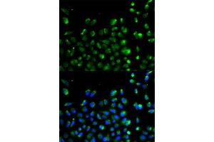 Immunofluorescence analysis of A549 cell using ATG13 antibody.