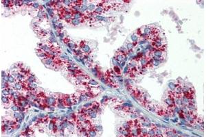 Human Prostate: Formalin-Fixed, Paraffin-Embedded (FFPE)