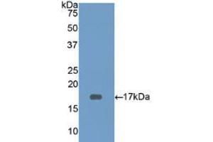 Western blot analysis of recombinant Human CD3d. (CD3D anticorps  (AA 18-113))