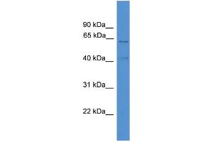 WB Suggested Anti-ACADVL  Antibody Titration: 0. (ACADVL anticorps  (C-Term))