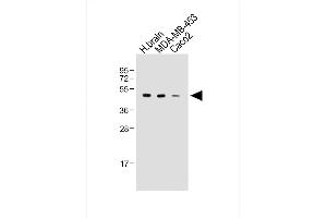 All lanes : Anti-KCNJ13 Antibody (N-term) at 1:2000 dilution Lane 1: Human brain whole tissue lysate Lane 2: MDA-MB-453 whole cell lysate Lane 3: Caco2 whole cell lysate Lysates/proteins at 20 μg per lane. (KCNJ13 anticorps  (N-Term))
