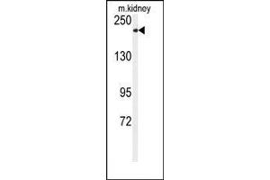 Image no. 1 for anti-Transient Receptor Potential Cation Channel, Subfamily M, Member 7 (TRPM7) (C-Term) antibody (ABIN360499)