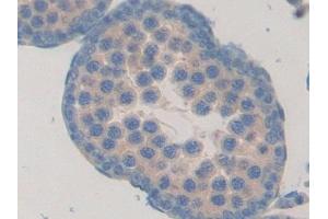Detection of FBLN1 in Rat Testis Tissue using Polyclonal Antibody to Fibulin 1 (FBLN1)