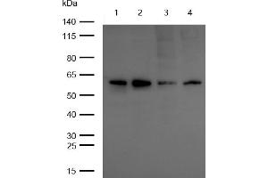 All lanes : YES1 Rabbit mAb at 1/1k dilution Lane 1 : JK whole cell lysates Lane 2 : HUVEC whole cell lysates Lane 3 : K562 whole cell lysates Lane 4 : HepG2 whole cell lysates Lysates/proteins at 20 μg per lane.