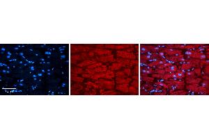 Rabbit Anti-TARDBP Antibody Catalog Number: ARP35838_P050 Formalin Fixed Paraffin Embedded Tissue: Human heart Tissue Observed Staining: Cytoplasmic Primary Antibody Concentration: 1:100 Other Working Concentrations: N/A Secondary Antibody: Donkey anti-Rabbit-Cy3 Secondary Antibody Concentration: 1:200 Magnification: 20X Exposure Time: 0.