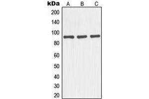 Western blot analysis of NOC3L expression in HEK293T (A), mouse liver (B), rat kidney (C) whole cell lysates. (NOC3L anticorps  (Center))