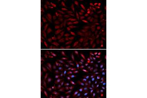 Immunofluorescence analysis of U2OS cells using PSMC2 antibody. (PSMC2 anticorps)