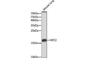 Western blot analysis of extracts of Mouse lung using NPC2 Polyclonal Antibody at dilution of 1:1000. (NPC2 anticorps)