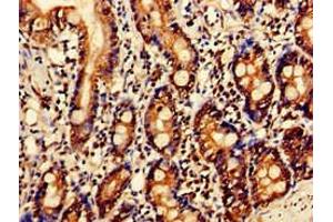 Immunohistochemistry of paraffin-embedded human small intestine tissue using ABIN7144337 at dilution of 1:100