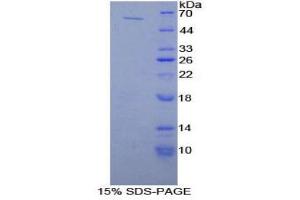 SDS-PAGE (SDS) image for Phospholipase A2-Activating Protein (PLAA) (AA 534-792) protein (His tag,GST tag) (ABIN1980783)