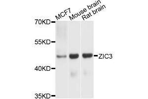 Western blot analysis of extracts of various cells, using ZIC3 antibody. (ZIC3 anticorps)