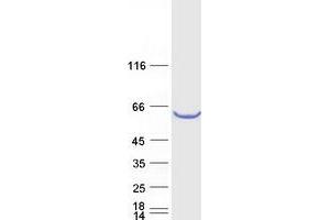 Validation with Western Blot