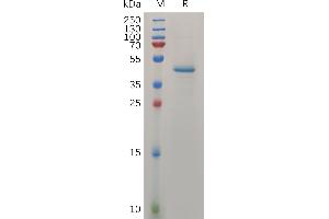 Human MDK Protein, hFc Tag on SDS-PAGE under reducing condition.