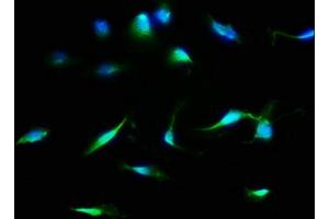 Immunofluorescence staining of U251 cells with ABIN7158941 at 1:133, counter-stained with DAPI. (MDH1 anticorps  (AA 1-334))