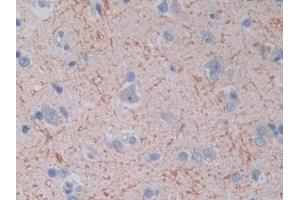 Detection of TOP3 in Human Cerebrum Tissue using Polyclonal Antibody to Topoisomerase III (TOP3) (TOP3A anticorps  (AA 35-179))