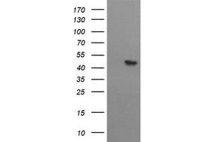Image no. 1 for anti-Mitochondrial Methionyl-tRNA Formyltransferase (MTFMT) (AA 175-389) antibody (ABIN1491021) (MTFMT anticorps  (AA 175-389))