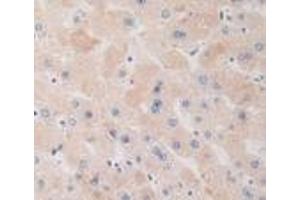 Detection of DRD1 in Human Liver Tissue using Polyclonal Antibody to Dopamine Receptor D1 (DRD1) (Dopamine Receptor d1 anticorps  (AA 338-446))