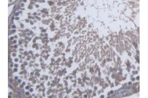 DAB staining on IHC-P; Samples: Rat Testis Tissue