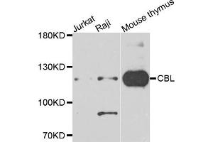 Western blot analysis of extracts of various cells, using CBL antibody. (CBL anticorps)
