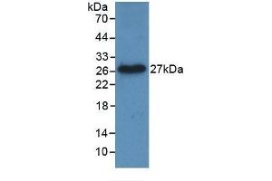 Detection of Recombinant TNFSF14, Human using Monoclonal Antibody to Tumor Necrosis Factor Ligand Superfamily, Member 14 (TNFSF14) (TNFSF14 anticorps  (AA 62-240))