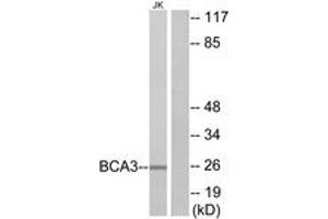 Western blot analysis of extracts from Jurkat cells, using BCA3 Antibody.