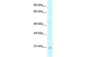 WB Suggested Anti-Twist1 Antibody Titration: 1. (TWIST1 anticorps  (N-Term))