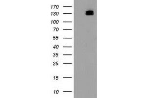 Western Blotting (WB) image for anti-Histone Deacetylase 6 (HDAC6) antibody (ABIN1498619) (HDAC6 anticorps)