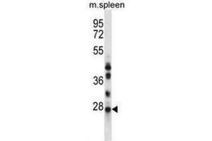 NQO2 Antibody (N-term) western blot analysis in mouse spleen tissue lysates (35µg/lane). (NQO2 anticorps  (N-Term))