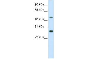 WB Suggested Anti-SPZ1 Antibody Titration:  2. (SPZ1 anticorps  (C-Term))