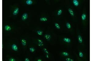 IF analysis of Ubc13/UBE2N using anti-Ubc13/UBE2N antibody (ABIN7599924).