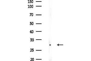Western blot analysis of lysates from COLO205 cells(UV 30 min treatment), using Phospho-AQP2 (Ser269) Antibody at 1/1000 dilution.