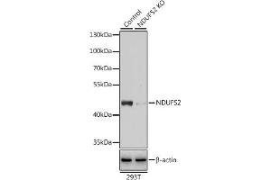 Western blot analysis of extracts from normal (control) and NDUFS2 knockout (KO) 293T cells, using NDUFS2 antibody (ABIN6133022, ABIN6144484, ABIN6144485 and ABIN7101413) at 1:3000 dilution.