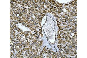 IHC analysis of NDUFS2 using anti-NDUFS2 antibody (ABIN7599417).