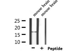anti-Calmodulin Like Protein 3 (CALML3) (Internal Region) antibody