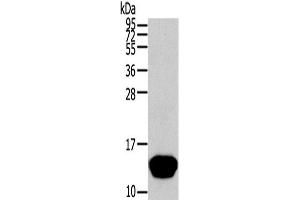 Western Blot analysis of Human normal liver tissue using THRSP Polyclonal Antibody at dilution of 1/400 (THRSP anticorps)